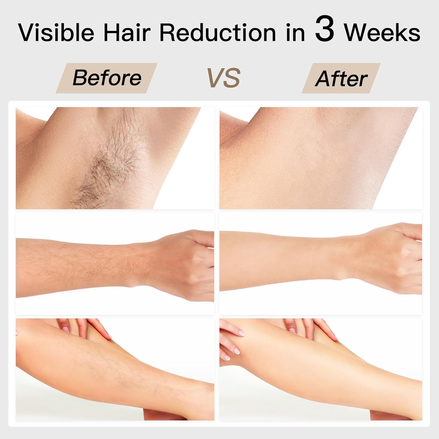 Laser Hair Removal, BoSidin IPL Hair Removal with Painless Ice-Cooling, 2-in-1 Face SR Rejuvenation, 6+1 Modes, 6 Levels Hair Removal - SmartGatelb